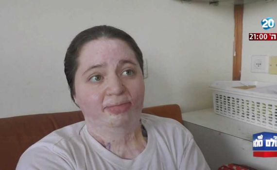 צפו: איילה שפירא מתראיינת בפנים גלויות