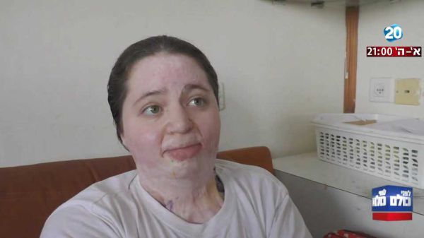 צפו: איילה שפירא מתראיינת בפנים גלויות