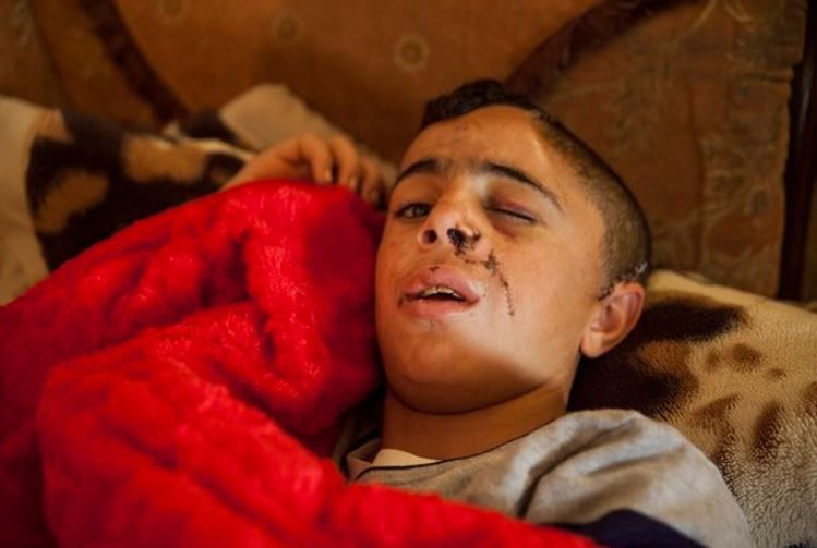 מלחמת גרסאות: איך נפצע בן דודה של עהד תמימי?