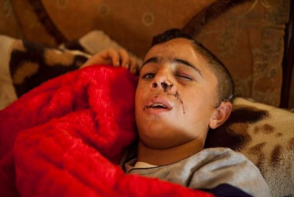 מלחמת גרסאות: איך נפצע בן דודה של עהד תמימי?