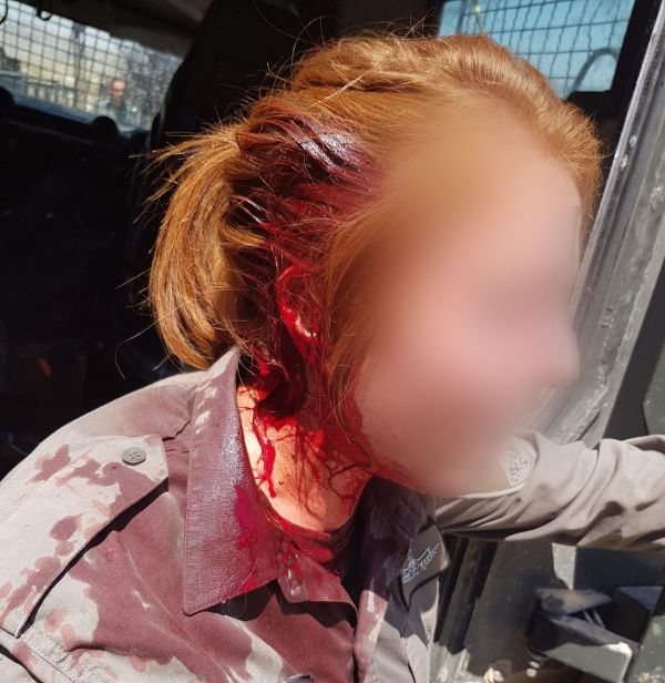 בושה: נערי גבעות פצעו חיילת מג"ב בראשה. צפו