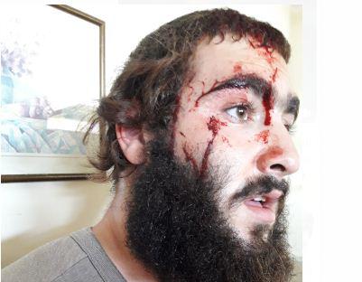 תיעוד: לפני שבת- יהודים עברו לינץ' בצפון