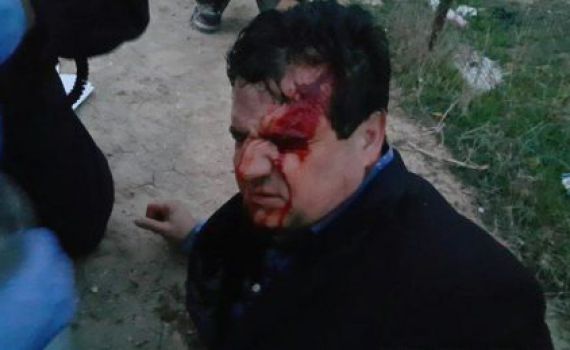 נסגר התיק נגד השוטרים שהתעמתו עם ח"כ עודה