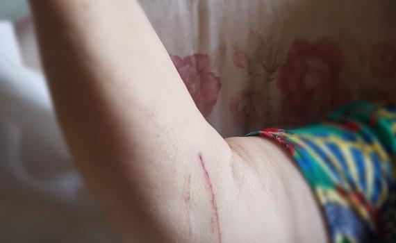 נערים היכו במקל קשישים שהעירו להם על רעש