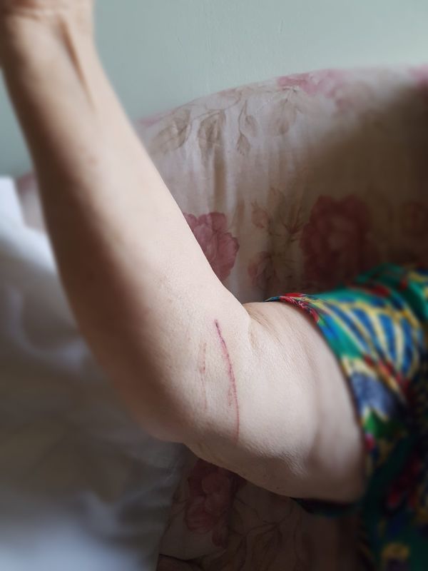 נערים היכו במקל קשישים שהעירו להם על רעש