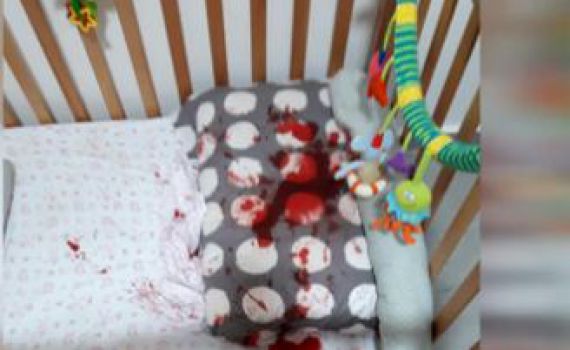 אימה במיטת התינוקת:'רצנו אליה,היא הייתה מלאה בדם'