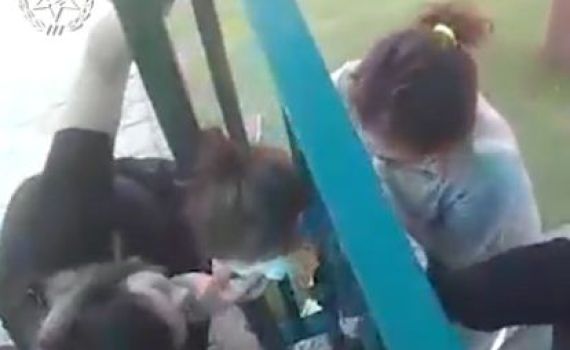 שוטרים חילצו ילדה שראשה נתקע בין סורגים. צפו