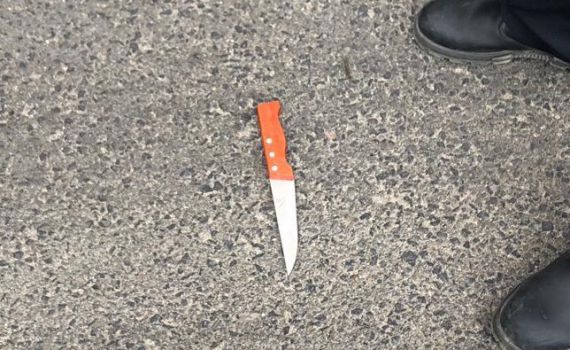 אירוע דקירה בירושלים: אישה כבת 30 נפצעה קל