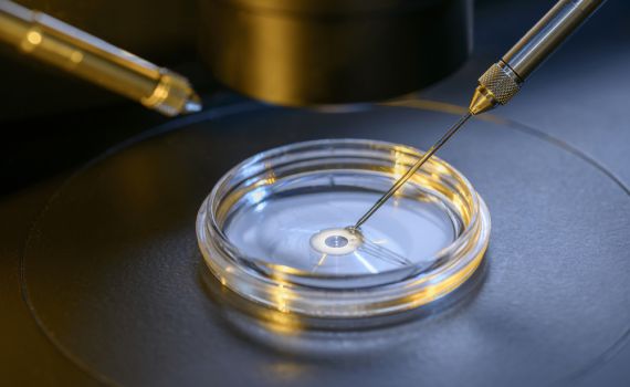 ההשגחה בטיפולי פוריות: דבר שעבר זמנו