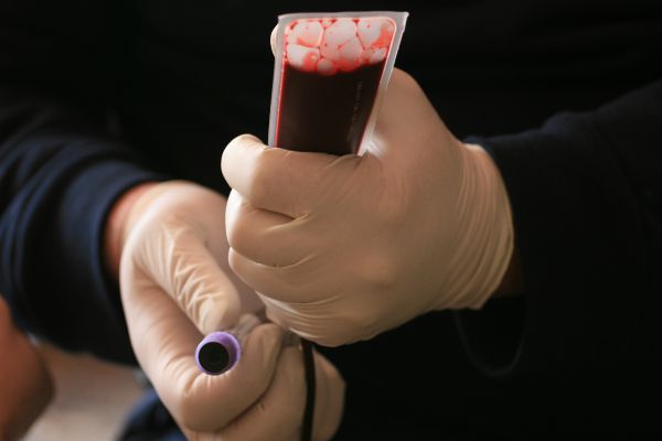 לפני פסח: מד"א מזהיר מפני מחסור חמור בדם