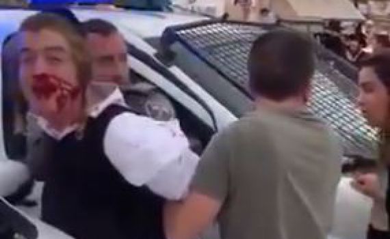 "תקיפת הילד מבחילה ובלתי אנושית- להדיח את השוטר"