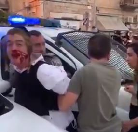 "תקיפת הילד מבחילה ובלתי אנושית- להדיח את השוטר"