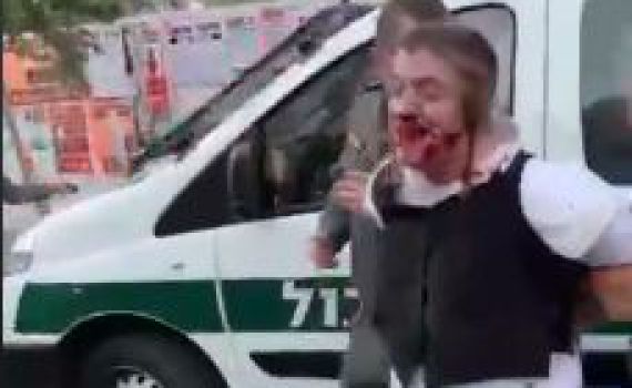 ארדן על תקיפת הנער: "תתבצע בדיקה מקיפה"