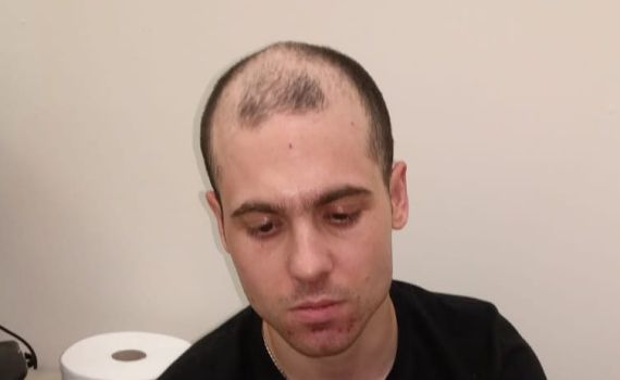 עציר "מסוכן ואלים" ברח מבית חולים פסיכיאטרי