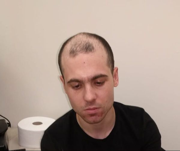 עציר "מסוכן ואלים" ברח מבית חולים פסיכיאטרי