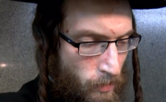 החרדי שמשכו בפאותיו: "אמרו לי אתה תמות היום"