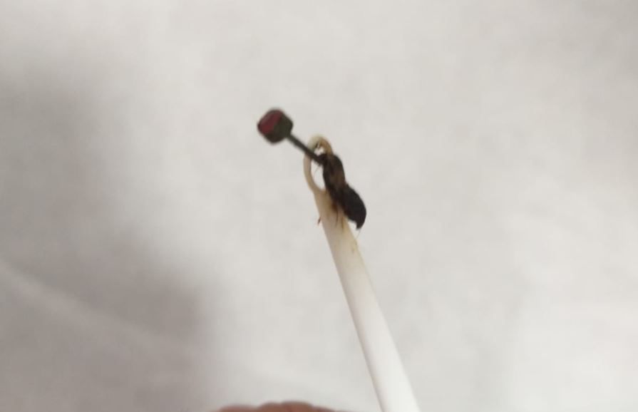 התלוננה על דלקת גרון; אך הרופא מצא משהו אחר לגמרי