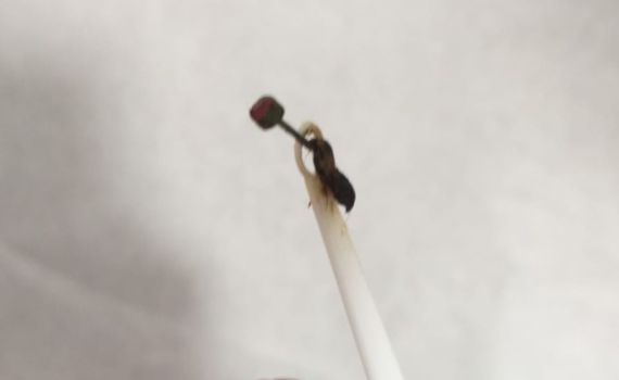 התלוננה על דלקת גרון; אך הרופא מצא משהו אחר לגמרי