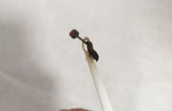 התלוננה על דלקת גרון; אך הרופא מצא משהו אחר לגמרי