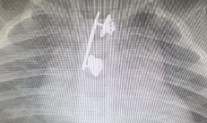 סיכת המ"מ של הקצינה נמצאה בוושת של בנה הפעוט