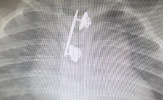 סיכת המ"מ של הקצינה נמצאה בוושת של בנה הפעוט