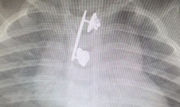 סיכת המ"מ של הקצינה נמצאה בוושת של בנה הפעוט