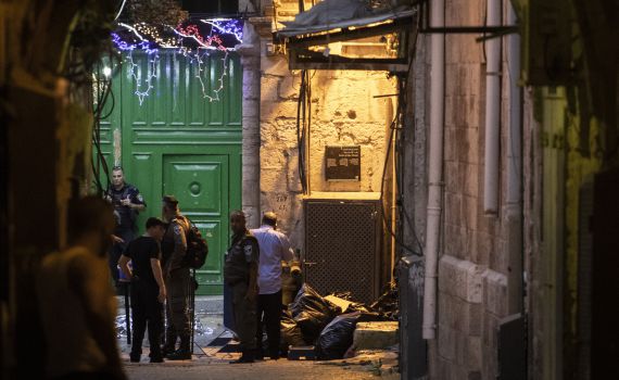 השוטר שנפצע בפיגוע בירושלים שוחרר מביה"ח