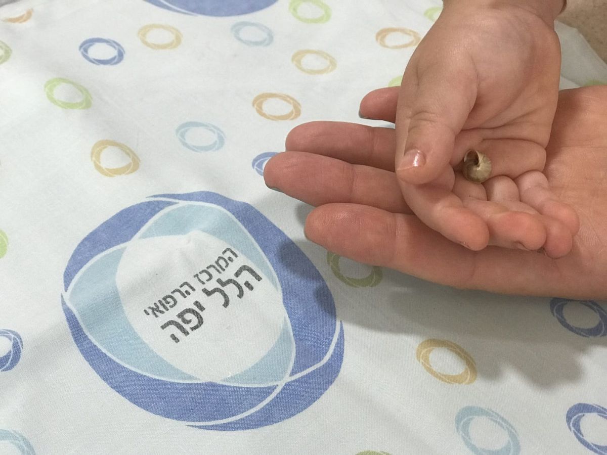 חילוץ דרמטי: חילזון הוצא מאפו של פעוט בן שלוש