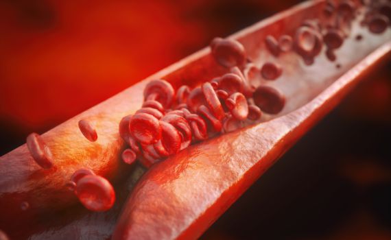 מניעה והורדת כולסטרול: כך נשמרים מפני טרשת עורקים