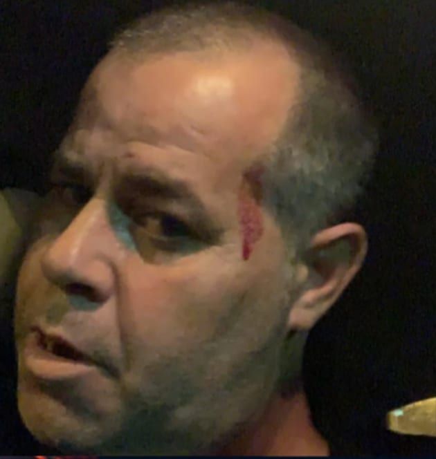 החשוד בתקיפת כתב ישראל היום הורשע בהריגת אדם אחר