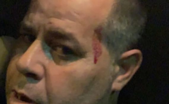 החשוד בתקיפת כתב ישראל היום הורשע בהריגת אדם אחר