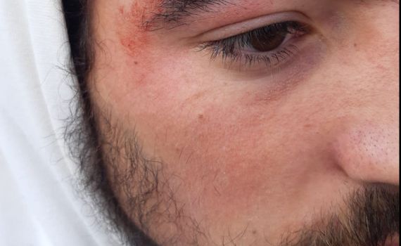 עימותים ביצהר: פלסטינים יידו אבנים, תושב נפצע קל