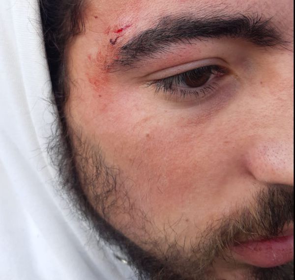 עימותים ביצהר: פלסטינים יידו אבנים, תושב נפצע קל