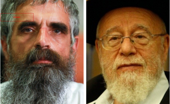 רבנים סרוגים תומכים בכנס מתנגדי החיסונים