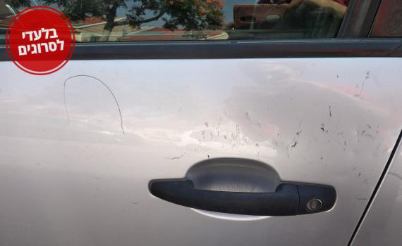 הדסה ניצלה מפיגוע אבנים: "איך ממשיכים לחיות כך?"