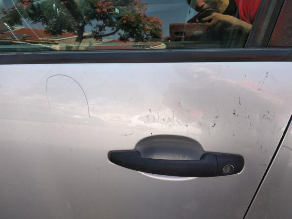 הדסה ניצלה מפיגוע אבנים: "איך ממשיכים לחיות כך?"