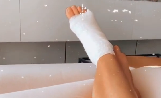 הזמרת הישראלית חושפת: "חטפתי סרטן בזרת"