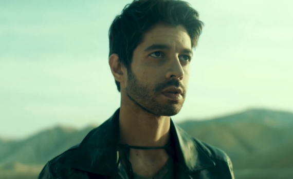 במהלך צילומים: שי גבסו נעקץ ופונה בדחיפות לטיפול