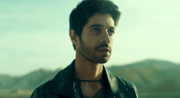 במהלך צילומים: שי גבסו נעקץ ופונה בדחיפות לטיפול