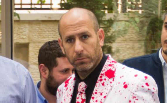 חנוך דאום מכה על חטא: "זו לא הייתה עיתונות"