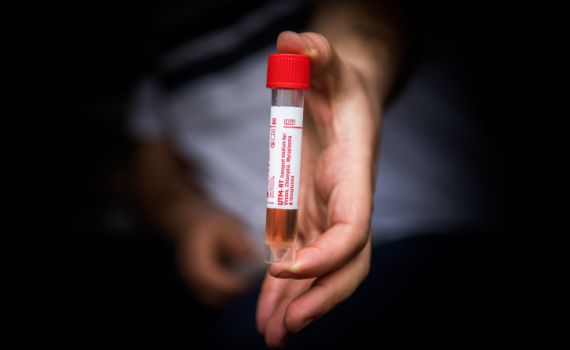 במבצע לילי: המוסד הביא 100 אלף בדיקות קורונה מחו"ל