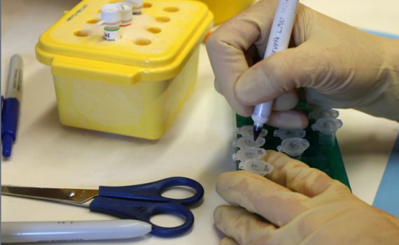 הסיבה לעיכוב בפרסום מספר חולי הקורונה