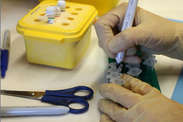 הסיבה לעיכוב בפרסום מספר חולי הקורונה