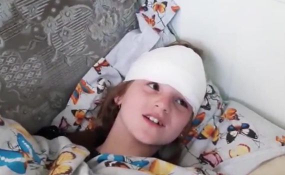 הילדה החרדית משחזרת: "הרגשתי שאני נשרפת"