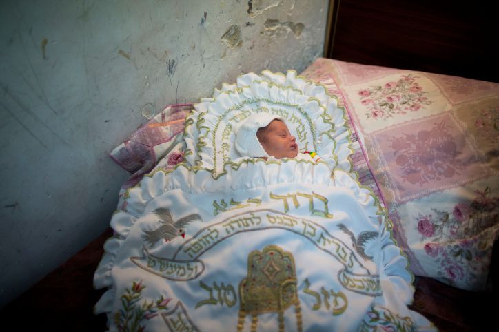 המוהל גרם לתינוק זיהום מוחי; מצבו קשה