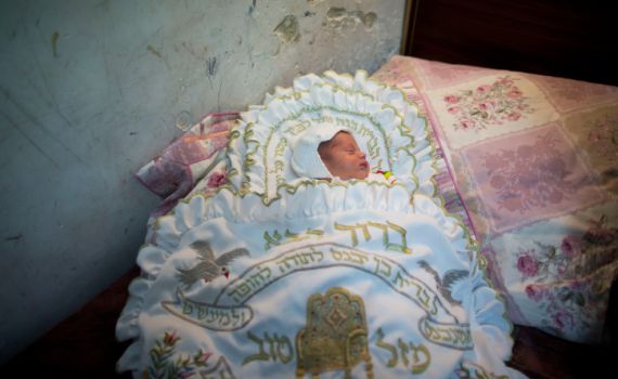 המוהל גרם לתינוק זיהום מוחי; מצבו קשה