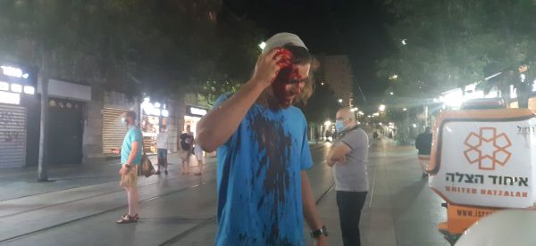 ארגון להב"ה: להט"בים תקפו פעיל בארגון