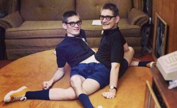 בגיל 68: מתו התאומים הסיאמים המבוגרים ביותר