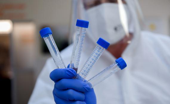 גילוי מרעיש: חוקר ישראלי איתר תרופה לקורונה