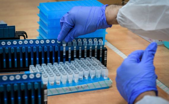 הצלה מקורונה: אמירת פיטום הקטורת בר"ח אב